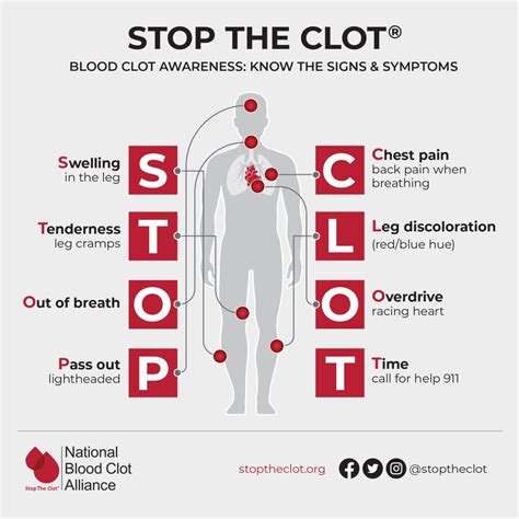 lottery number for blood clot|Thrombosis: Symptoms & Treatment .